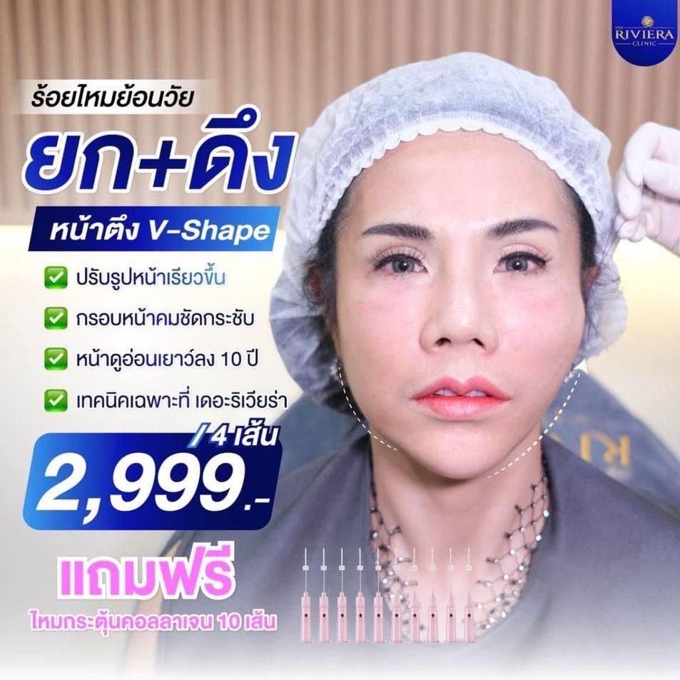 รีวิวร้อยไหม โคราช